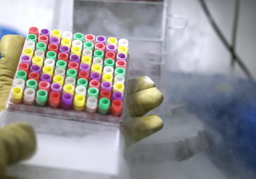 PoCOsteo-osteoporosis-cohort-web-2 PoCOsteo cohort, osteoporosis sample collection, Biobank Graz